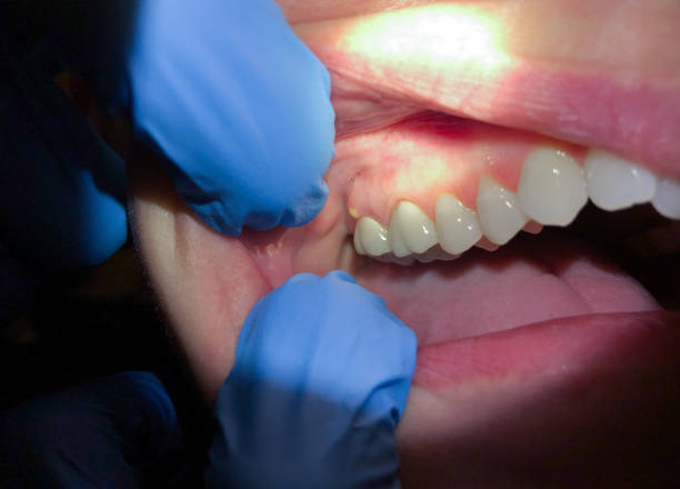 Best Pediatric Emergency Dentist in Oakley, KS