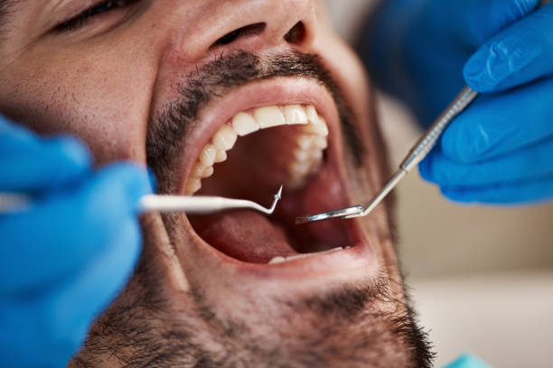 Best Emergency Root Canal Treatment in Oakley, KS