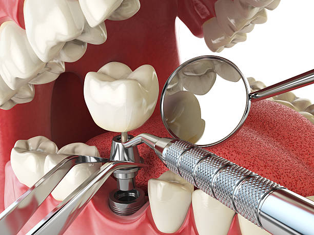 Best Emergency Dental Care for Broken or Chipped Teeth in Oakley, KS